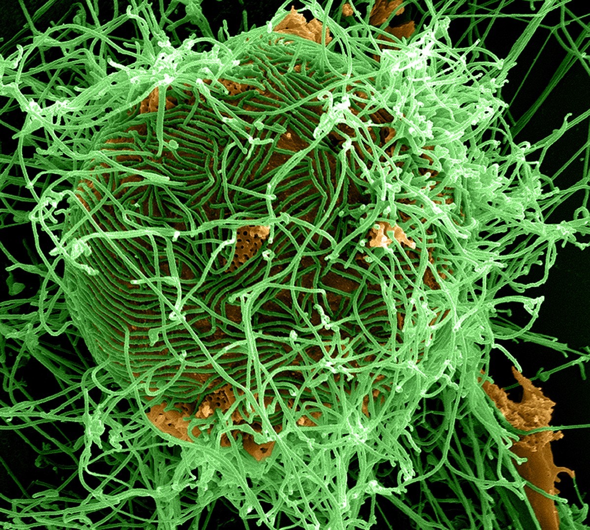 Ebola Comes to New York: Talks and Panels in NYC